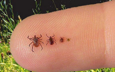 진드기로부터 직접 지역을 치료하는 방법