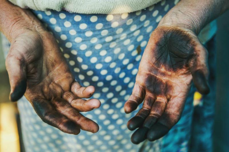 손에 버터 얼룩이 묻어있다