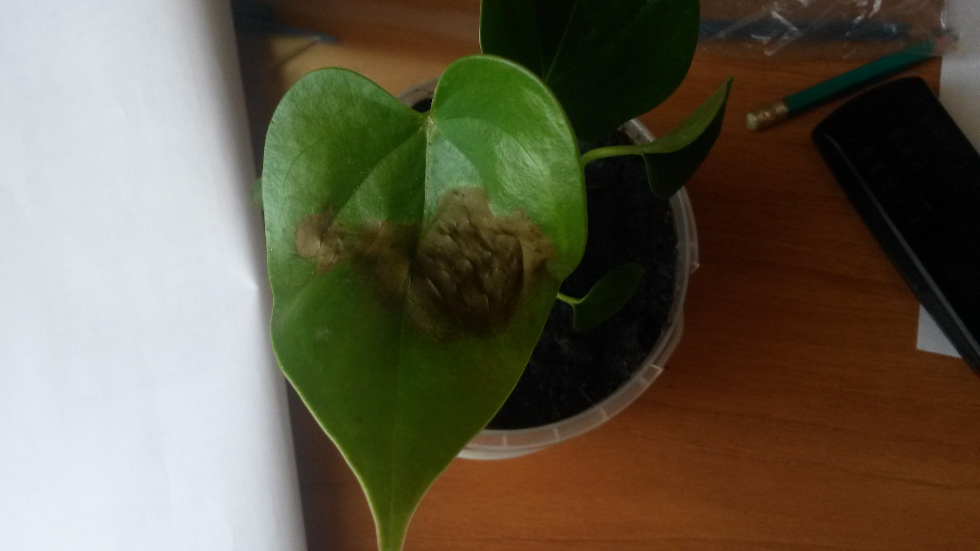 초안으로 인한 질병