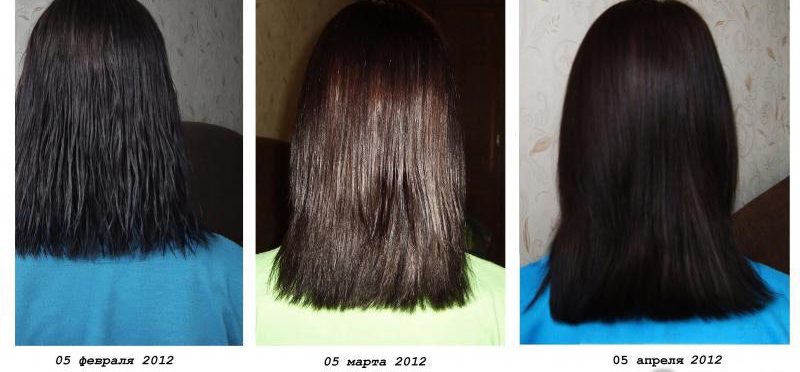 팅크제 사용 결과