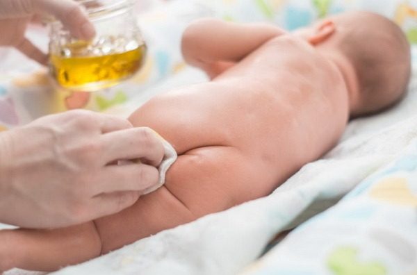 기저귀 발진 오일